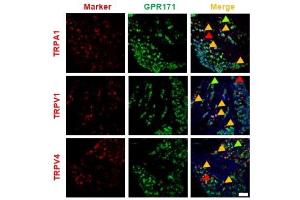 Double immunostaining of GPR171 expressions in Transient receptor potential (TRP)-expresser neurons and the effect on TRP-mediated nociceptions of GPR171 activation. (TRPA1 anticorps  (AA 1050-1120))