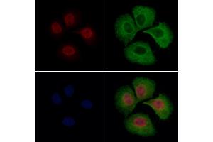 hFANCI Antibody staining Hela cells by IF/ICC. (FANCI anticorps  (C-Term))