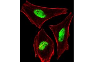Immunofluorescent analysis of 4 % paraformaldehyde-fixed, 0.