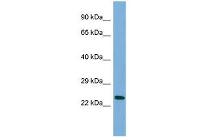 Host:  Rabbit  Target Name:  MANEAL  Sample Type:  HepG2 Whole cell lysates  Antibody Dilution:  1. (MANEAL anticorps  (Middle Region))