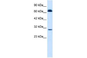 WB Suggested Anti-SIRT3 Antibody Titration:  0. (SIRT3 anticorps  (C-Term))