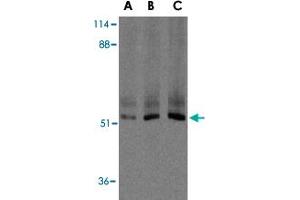 Western blot analysis of XIAP in human kidney lysate with XIAP polyclonal antibody  at 0. (XIAP anticorps  (C-Term))