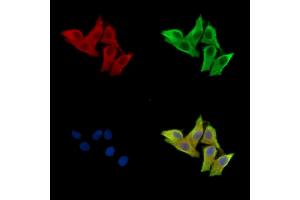 ABIN7096590 and ABIN7100654 staining HepG2 cells by IF/ICC. (MARCO anticorps)
