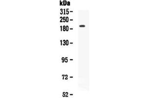 Western blot analysis of VEGF Receptor 2 using anti-VEGF Receptor 2 antibody . (VEGFR2/CD309 anticorps  (AA 20-244))