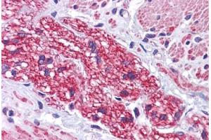 Human Colon, Nerve: Formalin-Fixed, Paraffin-Embedded (FFPE)