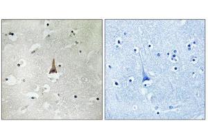 Immunohistochemistry analysis of paraffin-embedded human brain tissue using LRP10 antibody. (LRP10 anticorps  (Internal Region))