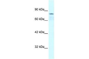 Human Jurkat; WB Suggested Anti-COLEC12 Antibody Titration: 0. (COLEC12 anticorps  (Middle Region))