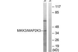 Western blot analysis of extracts from Jurkat cells, treated with serum 20% 15', using MAP2K3 (Ab-222) Antibody. (MAP2K3 anticorps  (AA 188-237))
