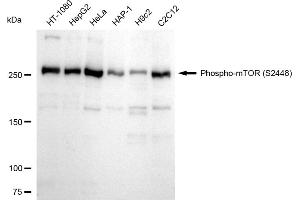 Western blotting analysis using Phospho-mTOR (S(ABIN7800001) antibody (ABIN7799348). (Recombinant MTOR anticorps  (pSer2448))