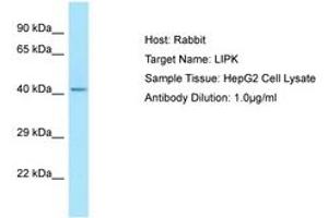 Image no. 1 for anti-Lipase, Family Member K (LIPK) (N-Term) antibody (ABIN6750053) (LIPK anticorps  (N-Term))