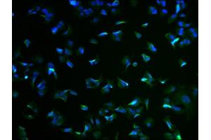 Immunofluorescence staining of MCF-7 cells with ABIN7167574 at 1:100, counter-stained with DAPI. (RIMS4 anticorps  (AA 1-269))