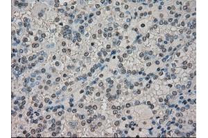 Image no. 1 for anti-Dihydrofolate Reductase (DHFR) antibody (ABIN1497822)