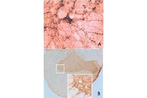 Immunohistochemical staining of SNCB in rat spinal cord using SNCB polyclonal antibody  at a dilution of 1 : 1000. (beta Synuclein anticorps  (AA 108-125))