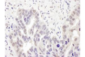 anti-Polymerase (DNA Directed), delta 2, Accessory Subunit (POLD2) (AA 419-469) antibody
