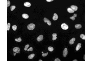 Immunofluorescent staining of U-2 OS (ATCC HTB-96) cells. (PARP1 anticorps)