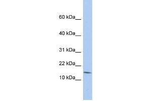 WB Suggested Anti-BTG2 Antibody Titration:  0. (BTG2 anticorps  (N-Term))