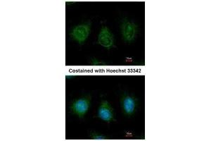 ICC/IF Image Immunofluorescence analysis of methanol-fixed HeLa, using DAK, antibody at 1:500 dilution.