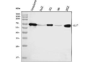 Western blot analysis of ALPP using anti-ALPP antibody (ABIN7602772).