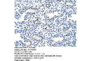 Rabbit Anti-PAIP1 Antibody  Paraffin Embedded Tissue: Human Lung Cellular Data: Alveolar cells Antibody Concentration: 4. (PAIP1 anticorps  (C-Term))