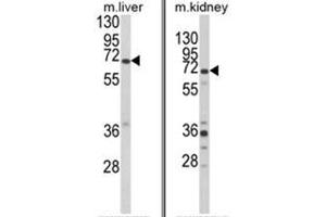 (LEFT) Western blot analysis of EHHADH Antibody (C-term) in mouse liver tissue lysates (35ug/lane). (EHHADH anticorps  (C-Term))