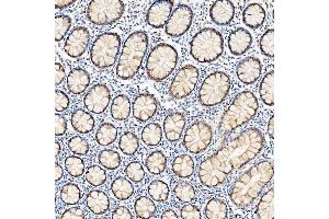 IHC analysis of U1-C/SNRPC using anti-U1-C/SNRPC antibody (ABIN7599016).