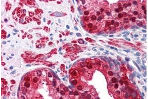 Human Prostate: Formalin-Fixed, Paraffin-Embedded (FFPE) (IDH1 anticorps  (AA 30-307))