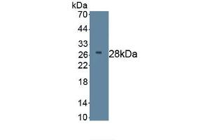 Detection of Recombinant DKK2, Human using Monoclonal Antibody to Dickkopf Related Protein 2 (DKK2) (DKK2 anticorps  (AA 38-258))