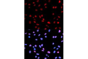 Immunofluorescence analysis of U2OS cell using Phospho-RB-S795 antibody. (Retinoblastoma 1 anticorps  (pSer795))