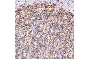 Immunohistochemistry of paraffin-embedded rat stomach using CTNN Rabbit mAb (ABIN7266135) at dilution of 1:100 (40x lens). (CTNNA3 anticorps)