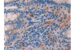 Detection of LCNL1 in Rat Small intestine Tissue using Polyclonal Antibody to Lipocalin Like Protein 1 (LCNL1) (LCNL1 anticorps)