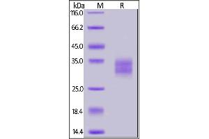 Biotinylated Human 4-1BB, His,Avitag™(MALS verified) on  under reducing (R) condition.