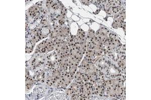 Immunohistochemical staining of human salivary gland with DNAJC6 polyclonal antibody  shows strong nuclear positivity in glandular cells at 1:200-1:500 dilution. (DNAJC6 anticorps)
