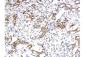 Formalin-fixed and paraffin embedded rat renal tubular endothelial cells labeled with Anti-EAAT3, Unconjugated (ABIN733943) followed by conjugation to the secondary antibody and DAB staining