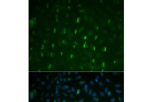 Immunofluorescence analysis of U2OS cells using Phospho-γH2A. (gamma H2AX anticorps  (pSer139))
