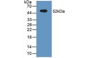 Detection of Recombinant MUC1, Mouse using Polyclonal Antibody to Mucin 1 (MUC1) (MUC1 anticorps  (AA 474-630))