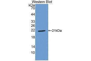 Detection of Recombinant GPX1, Human using Polyclonal Antibody to Glutathione Peroxidase 1 (GPX1)