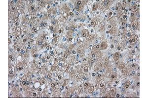 Immunohistochemical staining of paraffin-embedded prostate tissue using anti-PDE4A mouse monoclonal antibody. (PDE4A anticorps)