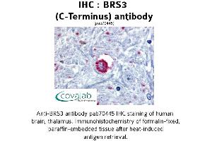 Image no. 1 for anti-Bombesin-Like Receptor 3 (BRS3) (C-Term), (Cytoplasmic Domain) antibody (ABIN1732418) (BRS3 anticorps  (C-Term, Cytoplasmic Domain))