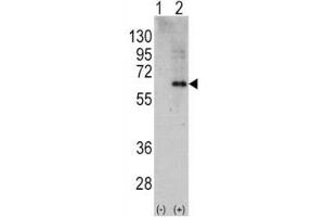 Western blot analysis of AMPK alpha 2 antibody and 293 cell lysate (2 ug/lane) either nontransfected (Lane 1) or transiently transfected with the PRKAA2 gene (2).