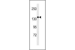 SGSM1 Antibody (Center) (ABIN1881801 and ABIN2843255) western blot analysis in MDA-M cell line lysates (35 μg/lane). (SGSM1 anticorps  (AA 624-652))