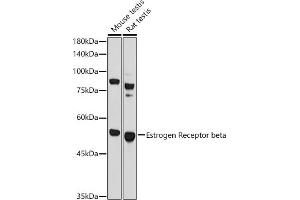 Western blot analysis of extracts of various cell lines, using Estrogen Receptor beta antibody (ABIN3016231, ABIN3016232, ABIN3016233 and ABIN6219642) at 1:1000 dilution. (ESR2 anticorps  (AA 1-280))