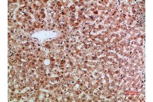 Immunohistochemical analysis of paraffin-embedded human-liver, antibody was diluted at 1:200