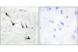 Immunohistochemistry analysis of paraffin-embedded human brain tissue, using Syntaxin 1A (Ab-14) Antibody.