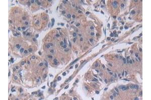 Detection of MMP23B in Human Stomach Tissue using Polyclonal Antibody to Matrix Metalloproteinase 23B (MMP23B) (MMP23B anticorps  (AA 79-390))