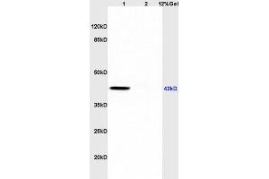 L1 rat brain, L2 rat heart lysates probed (ABIN723725) at 1:200 in 4 °C.