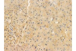 ABIN6265555 and ABIN6266853 at 1/100 staining human normal liver tissue by IHC-P. (Transglutaminase 2 anticorps  (N-Term))