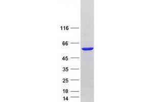 Validation with Western Blot
