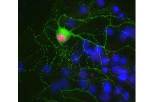 Indirect immunostaining of PFA fixed rat hippocampus neurons with anti-Ctip 2 (dilution 1 : 500; red) and mouse anti-MAP 2 (cat.