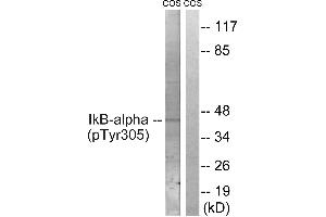 Immunohistochemistry analysis of paraffin-embedded human lymph node tissue using IκB-α (Phospho-Tyr305) antibody. (NFKBIA anticorps  (pTyr305))