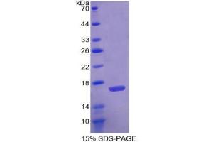 SDS-PAGE analysis of Human Agmatine Ureohydrolase Protein. (AGMAT Protéine)